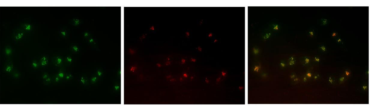 CYTO-ID® 自噬检测试剂盒                              CYTO-ID® Autophagy detection kit