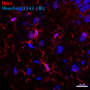 小胶质细胞标记物抗体——Anti Iba1抗体